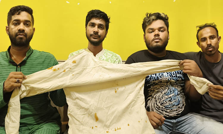 জুলাইয়ে পুলিশের গুলিতে আহত মিলনের নাম নেই আহতদের তালিকায়